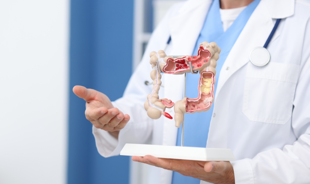 Disturbi intestinali post feste? Ritrova l'equilibrio