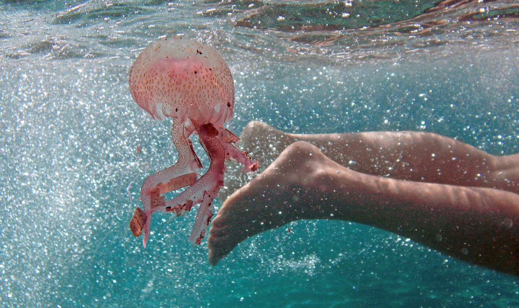 I falsi miti sulle cure contro il morso di medusa